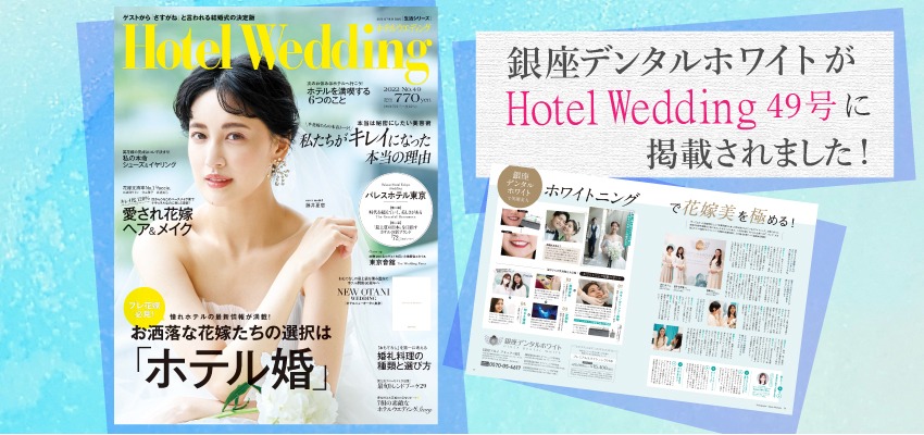 【雑誌掲載告知】銀座デンタルホワイトがHotel Wedding49号に掲載されました!