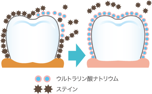 ウルトラリン酸ナトリウムがステインの再付着を防ぎます。